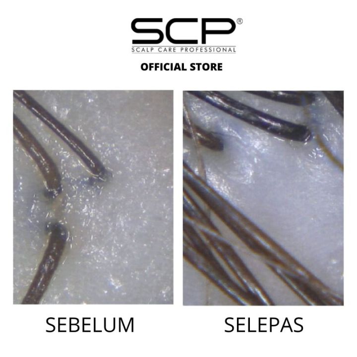 SCP [HALAL] Shampoo Mengimbangi/Rambut Nipis/ Balancing & Thinning Hair ...