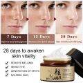 30g Whitening melasma cream Freckle Removing Cream pekas cream original japan  Remove Wrinkles Cream Pekas Remover Cream Blemish Cream Remove Melasma Freckles Anti Aging Serum Sunburn remove dark spot on face pikas remover cream Moisturizing Cream. 