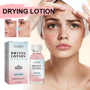 EELHOE Salicylic Acid Facial Moisturizing Lotion Shrink Pores Nourishing Damaged Skin Treatment Acne Remove Spot Whitening Face Essence Salicylic Acid Acne Drying Lotion Salicylic Acid Deeply Removes Acne Repair Facial Moisturizing Hydrating Serum