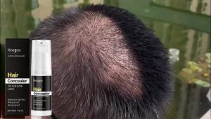 🔥 Hot!Hoegoa  Hairline Concealer   Hair Hair Seam Filling Forehead Shadow Fluffy Daily Hair Covering Cream