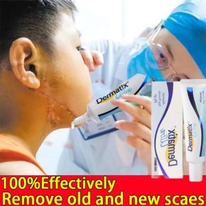 [HCM]Kem seo Dermatix Ultra hỗ trợ làm phẳng mềm và mờ sẹo lồi sẹo thâm sẹo phì đại - Bảo vệ da khỏi tia UVA và UVB - Hộp 15 gram