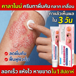 บรรเทาอาการคัน ครีมลดอาการคัน าสะเก็ดเงิน ผิวหนังอักเสบ ติดเชื้อรา สะเก็ดเงิน แบคทีเรีย คัน กลาก เกลื้อน ครีมแก้คัน