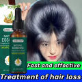 Penumbuh rambut cepat dan tebal Menyehatkan Kulit Kepala&Meningkatkan Regenerasi Rambut - Penumbuh rambut botak ampuh - Obat penumbuh rambut super cepat - Penumbuh rambut botak paling cepat - obat penumbuh rambut botak - Rambut rontok perawatan. 