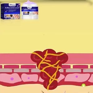 30g Antibacterial Cream Anti Itch Cream Psoriasis Eczema Rash Itchy Skin Allergy Treatment Cream