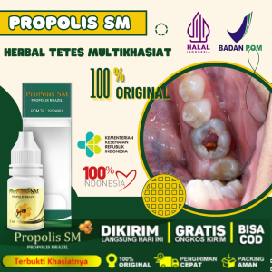 Obat Sakit Gigi Berlubang Nyeri Gusi Gigi Berlubang Gusi Bengkak Nyut Nyutan Sakit Gigi Kropok Gigi Goyang - ProPolis SM
