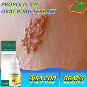 Obat Puru / Patek / YAWS - Pengobatan Puru Sunut - Puru Api - Puru Sundut - Obat Penyakit Puru Sumut