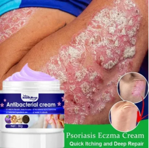 Herbal Antibacterial Cream Natural Viola Anti-Itch Cream Dyshidrosis Treatment Eczema Treatment Cream Topical Psoriasis Cream Anti-Itch Gout Ointment Rash Urticaria Treatment Ointment Skin Anti-Itching Ointment 30g