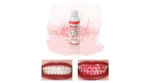 Thuốc phát hiện mảng bám 60ml dụng cụ chỉ thị mảng bám nha khoa có cốc đo kiểm tra cao răng cho răng trẻ em hoặc người lớn xác định mảng bám quan tâm đến vệ sinh răng miệng của bạn.