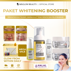 Ms Glow Paket Wajah Whitening Untuk Kulit Kusam