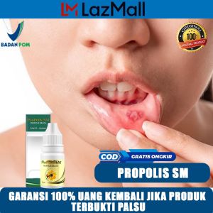Obat Sariawan / Sariawan Parah / Sariawan Berdarah / Radang Sariawan / Sariawan Susah Sembuh / Sariawan Menahun / Obat Sariawan Di Lidah Sakit Herbal Propolis SM Original Brazil HALAL BPOM