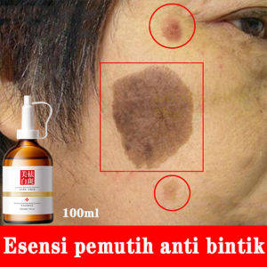 Freckle serum for Whitening and freckle removal chloasma age spots Hereditary spots Pigmented spots sunspot Herbal Whitening and Melasma Removal 100 g