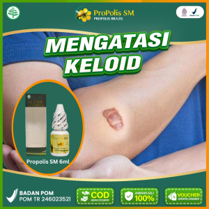 Obat Bekas Luka Keloid Bekas Luka Kecelakaan Operasi Koreng Hilangkan Benjolan di Kulit Propolis Sm