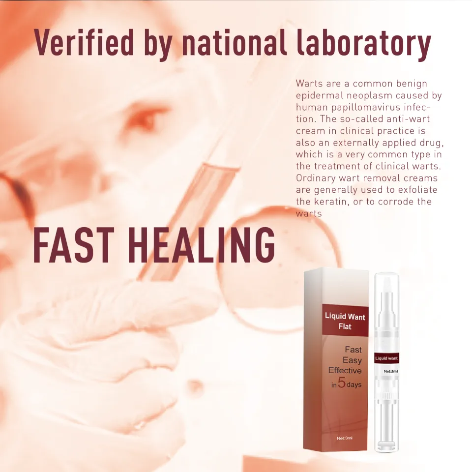 Jaysuing Liquid Wart Flat 3ml Cairan Menghilangkan Kutil dan