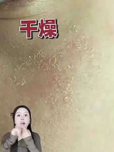 65% Rose Essential Oil - Firming and Anti-Wrinkle Moisturizing and Hydrating Whitening and Yellow-Red Reduction Reducing Fine Lines Facial Skin Care Product