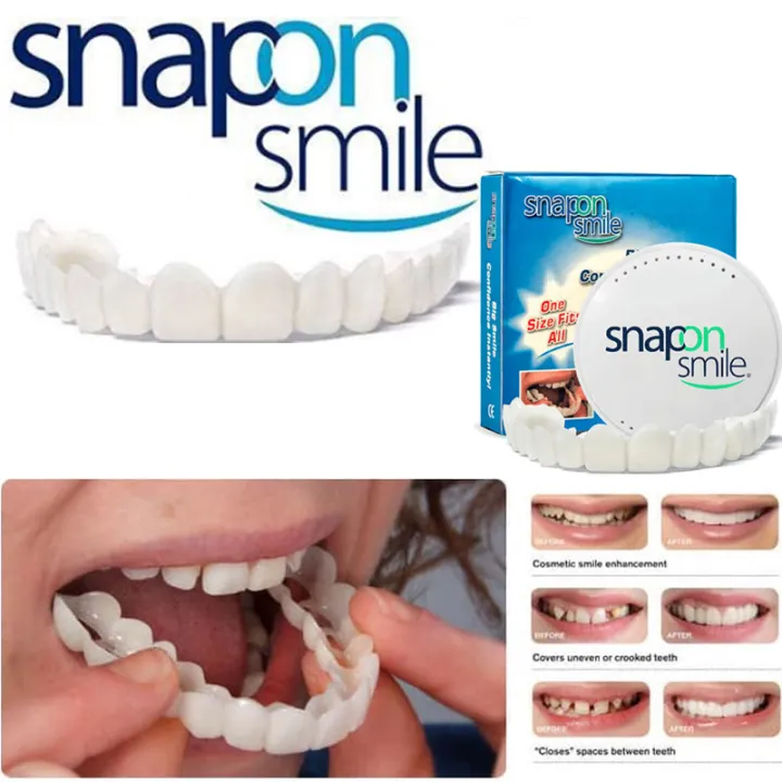 Snap%20On%20Smile%20Gigi%20Palsu%20Instant%20Tinggal%20Pasang%201%20Set%20Atas%20dan%20Bawah%20-%20Image%204