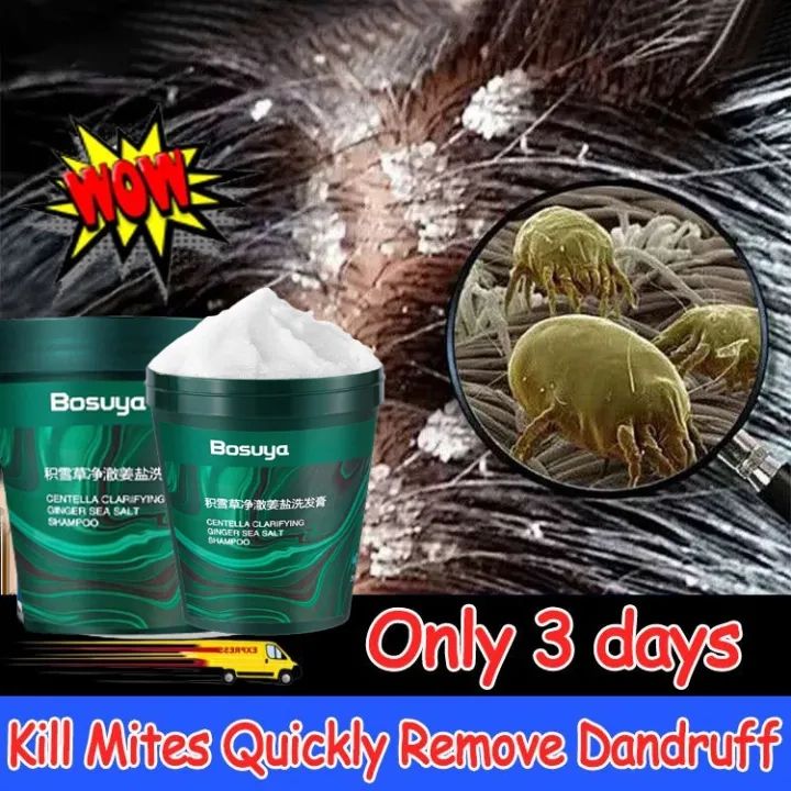 obat ketombe sampo anti ketombe dan gatal shampoo penghilang ketombe