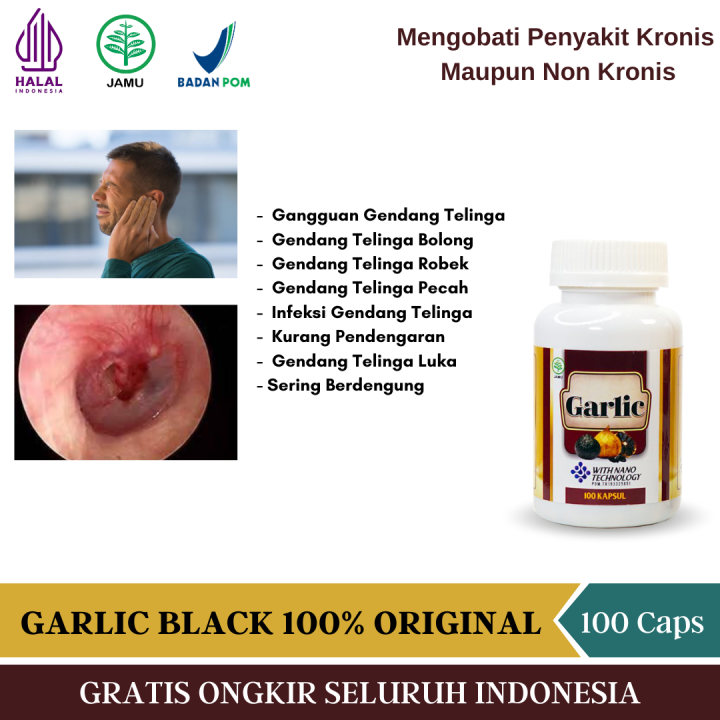 Obat Herbal Gangguan Gendang Telinga, Gendang Telinga Bolong, Gendang Telinga Robek, Gendang Telinga Pecah, Infeksi Gendang Telinga, Kurang Pendengaran, Gendang Telinga Luka, Sering Berdengung Dengan Garlic Kapsul Herbal