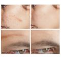 VIBRANT GLAMOUR Crocodile Scar Repair Toner Fade Scar Prevent Scar Hyperplasia Sensitive Skin Deep Care. 
