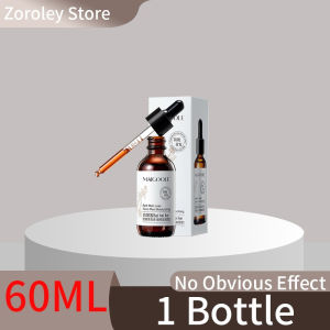 【Fast Effective 】Hair Growth Serum  Ginger Hair Tonic  30ML  Hair Growth For Men & Women Anti Hair Growth  Loss Preventiom Prevents Hair Supplement