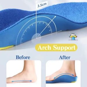 1Pair Orthotics Insoles Correction X O Type Legs Arch Support Shoes Cushion Children Feet Valgus Correction Flat Foot Feet Care foot Care