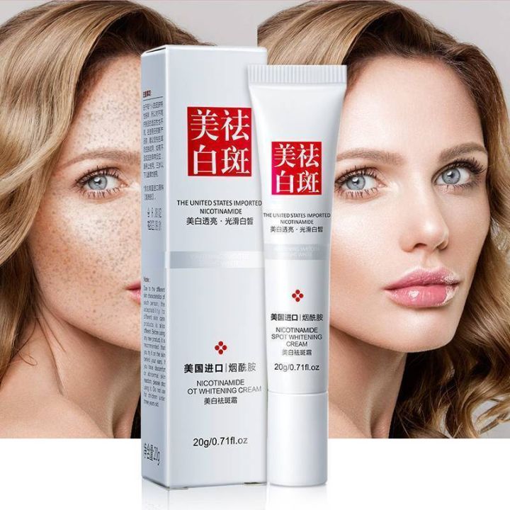 Whitening freckle cream pekas cream eraser original japan Anti Aging
