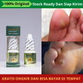 Obat Mata Ikan, Obat Mata Ikan di Jari Kaki, Obat Mata Ikan Alami, Obat Mata Ikan di Telapak Kaki, Obat Mengilangkan Mata Ikan di Kaki, Obat Buat Ngilangin Mata Ikan, Obat Nyeri Pasca Operasi Mata Ikan dengan Propolis SM. 