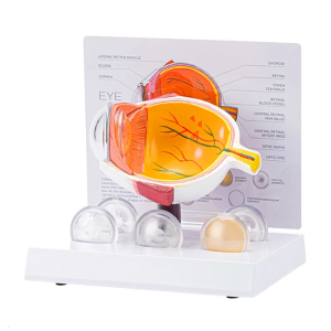 Pathological Eyeball Anatomy Model Human Anatomical Eye Model Teaching Tool for Clinical Setting Educational Use