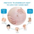 Anti-Stretch Mark Cream Dark Spot Remover Cellulite Remover Anti Scar Cream Firming Skin Cream Whitening Fades stretch marks Pregnancy repair cream Scars Repair Maternity Skin Repair Treatmen. 