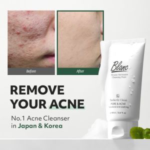 Blanc Nature Acne Pimple Cleanser 150ml Orgarnic Green tea Salicylic Acid Acne Treatment