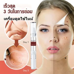 ปากกาหูด กําจัดหูดแบน น้ำยาหูด มีประสิทธิภาพ สารสกัดจากพืช เรียบง่ายไม่มีผลข้างเคียง ปลอดภัยและมีสุขภาพดี 祛疣笔 有效去除疣体