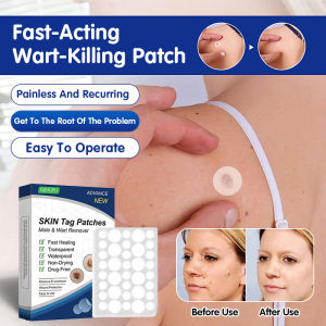 Wart Removal Patch For Home Skin Care Adults/Keratin Wart Patch/Direct To Root/Fast Effect/Personal Care/Face Body Blemishes Treatment