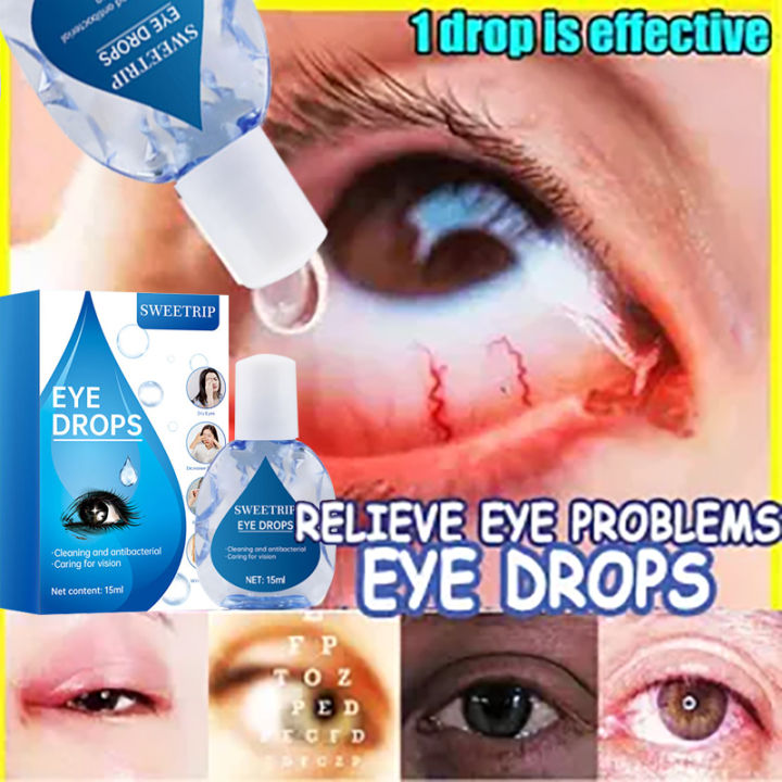 eye drops for cataract original 15ML eyedrops for tired eyes Dry sore ...