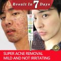 Acne Cream whitening moisturizing cream acne removal essence 30g facial essence cream scar acne remo Pimple Eraser. 