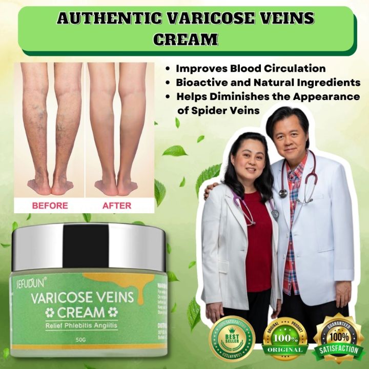 SEFUDUN Varicose Vein Remover ORIGINAL Effective Treatment Cream Spider ...