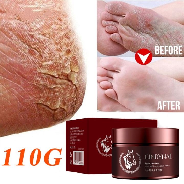 110g Horse Oil Callus Remover Foot Care Cream For Cracks And Dry