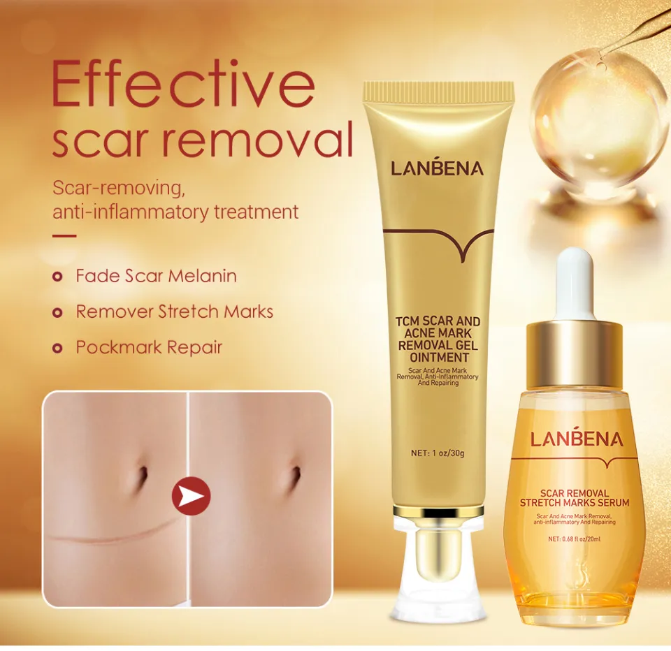 LANBENA Acne Scar Remove Serum Herbal Acne Treatment Cream Skin