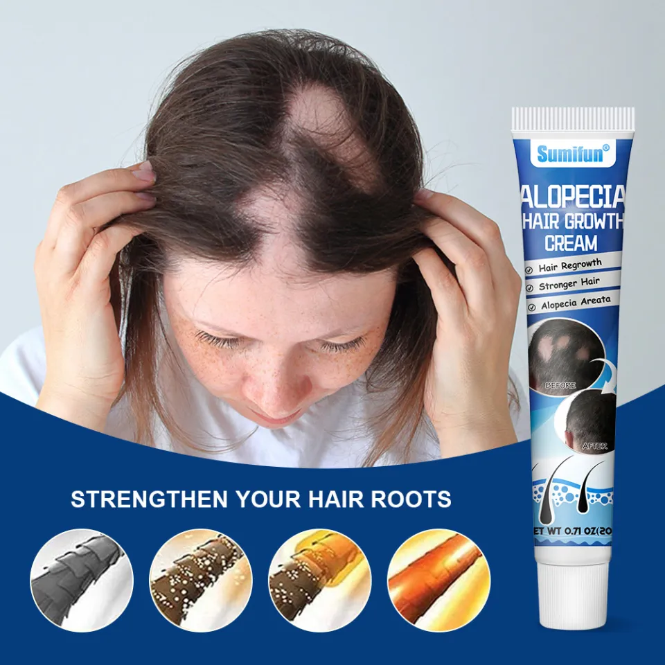 Alopecia Hair Growth Cream, Herbal Scalp Care for Solid Hair Roots