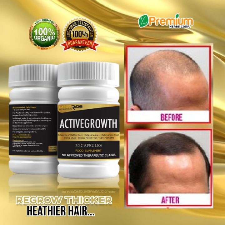 ACTIVE GROWTH - 100% Original: Your Ultimate Solution for Hair Growth ...