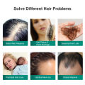 Natural Ginger Hair Growth Serum Preventing Hair Loss Thick Repair Growing Treatment Liquid Extract Essence Hair Growing Scalp. 