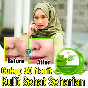 Cindynal Aloevera Soothing Gel Pelembab Kulit Wajah Kering Kusam Berjerawat Pengecil Pori2 Besar