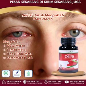 Oil Fit Kapsul - Obat Mata merah Mata Iritasi Mata Bengkak Berair Mata Buram Glaukoma Kalazion