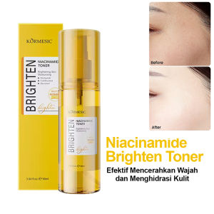 [BPOM] KORMESIC Niacinamide Toner Wajah Moisturizing Whitening 90ml / Toner Pencerah & Menyamarkan Noda Gelap di Wajah