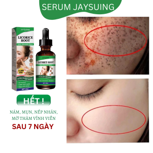 Tinh chất đánh bay mụn nám Jaysuing 30ml giúp tái tạo da mặt làm sáng và căng bóng da ngăn ngừa lão hóa dachống thâm mắt và bọng mắt một cách hiệu quả Tinh chất chống lão hóa chống nhăn căng bóng da ngừa nám tàn nhang