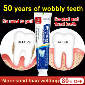 Improve Loose Teeth Care Toothpaste Fresh breath yellow teeth Remover