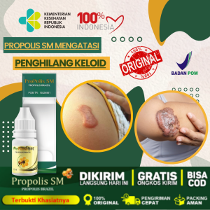 Obat Keloid Daging Tumbuh Daging Jadi Penghilang Keloid Luka Tindik Di Telinga Bekas Operasi Penghilang Keloid Berkerut Bekas Luka Menonjol Propolis sm Brazil Asli