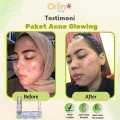 Orlin Beauty Paket Acne Glowing Platinum 4in1 Mencerahkan Wajah Kulit Sensitif Bekas Jerawat Flek Hitam Skincare BPOM. 