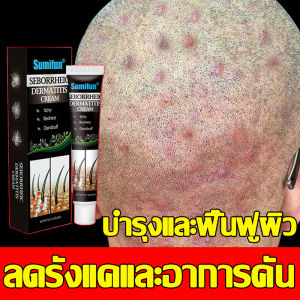 ครีมสมุนไพรบำรุงผิว ครีมลดอาการคัน แดง ลอก ครีมบำรุงผิวหน้าและผิวกาย สำหรับผิวแพ้ง่าย ให้ความชุ่มชื้น ฟื้นฟูผิวแห้งเสีย