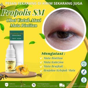Propolis Sm - Obat Mata Bintitan Mata Bintitan Bernanah Mata Kalazion Benjolan di Kelopak Mata Benjolan Merah