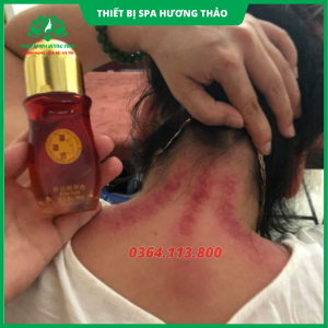 Dầu cạo gió cổn cổn thông đả thông kinh lạc giảm đau tức thì chai 60ml