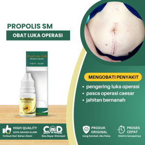 Obat Luka Operasi Obat Pengering Luka Operasi Obat Pasca Operasi Caesar Obat Luka Jaitan Bernanah Obat Pengering Luka Jahitan Obat Habis Sunat - Propolis SM